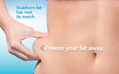 Hips treatment Busby From Lipo Sculpt
