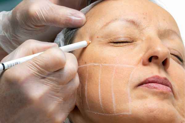CryoPen: 5 Skin Concerns It May Be Used to Treat 4 What should you ask before having CryoPen treatment Busby?