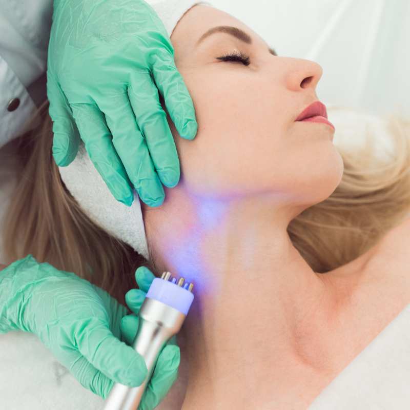 HIFU non surgical facelift