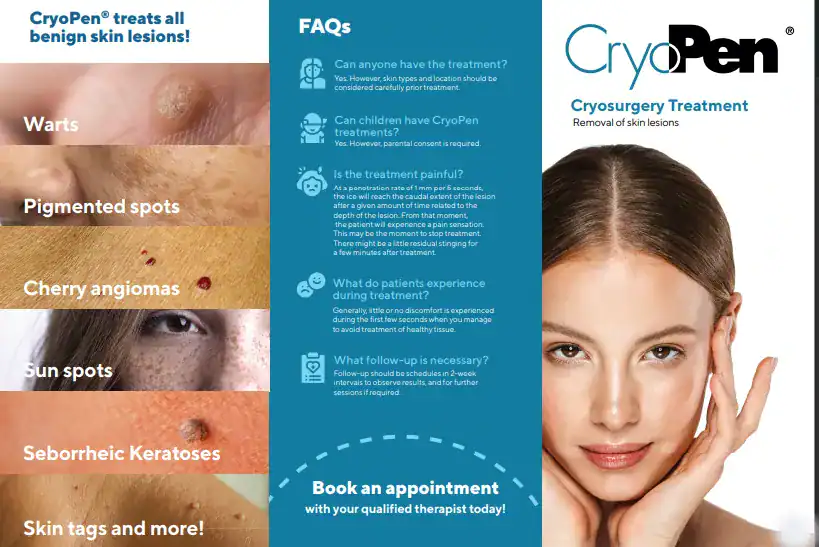 Benefits of Cryopen for seborrheic keratosis Removal Treatment Busby